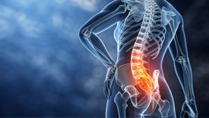 entrenar si tienes una hernia lumbar