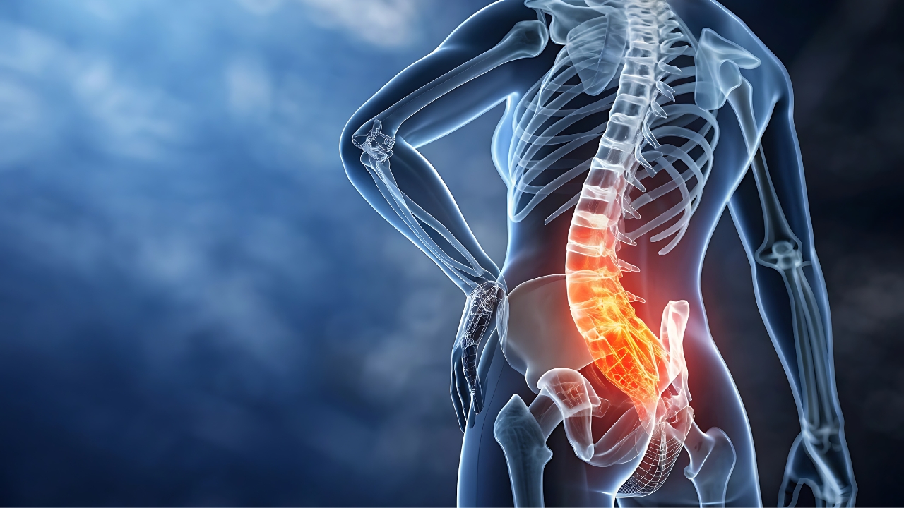 entrenar si tienes una hernia lumbar